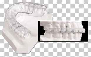 Mandibular Advancement Splint Dentistry Jaw Temporomandibular Joint Dysfunction PNG