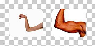 Muscle Weakness Arm Human Body PNG