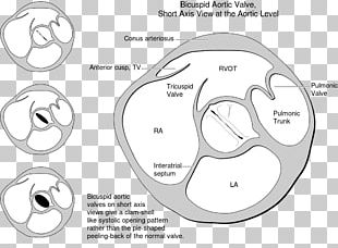 Heart Valve Mitral Valve Anatomy Pulmonary Valve PNG, Clipart, Angle ...