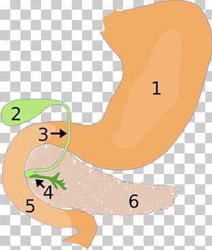 duodenal cap image clipart