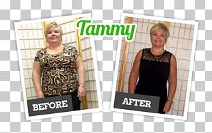 Success Weight Loss Exercise Diet Protein PNG