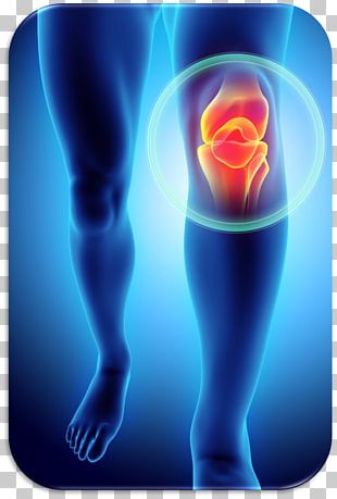 Patellofemoral Pain Syndrome PNG Images, Patellofemoral Pain Syndrome ...