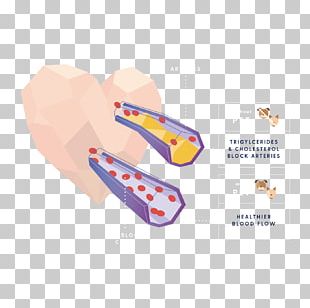 Beagle National Pet Month Reverse Sneezing Diabetes In Dogs PNG