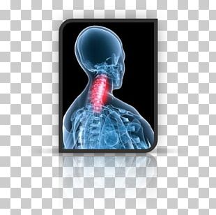 Neck Pain Spondylosis Disease Osteopathy PNG, Clipart, Ache, Arm, Back ...