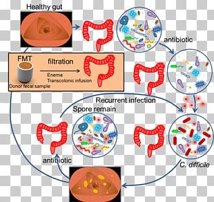 Fecal Microbiota Transplant PNG Images, Fecal Microbiota Transplant ...