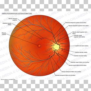 Dilated Fundus Examination PNG Images, Dilated Fundus Examination ...