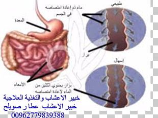 Diarrhea Therapy Child Herbalism Pathogenesis PNG