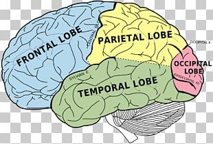 Cerebral Infarction Brain Cerebrovascular Disease PNG, Clipart, Brain ...