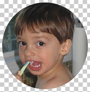 Cheek Tooth Decay Child Fluorine PNG