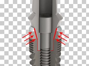 Dental Implant Abutment Dentistry OSSTEM IMPLANT PNG, Clipart, Abutment ...