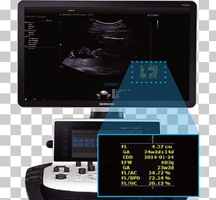 Ultrasound Ultrasonography Samsung Medison Samsung Electronics PNG