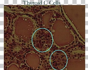 Parafollicular Cell Thyroid Endocrine System PNG