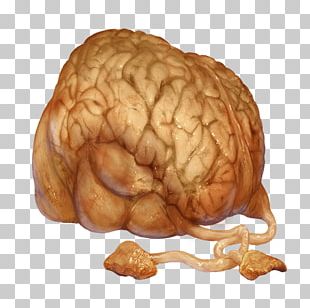 Warframe Norg Brain Eidolon Wikia PNG