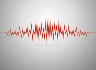 Sound Wave Audio Signal PNG, Clipart, Angle, Audio Signal, Black And ...