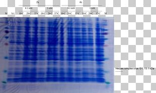 Western Blot Cell SDS-PAGE Staining Polyacrylamide Gel Electrophoresis PNG