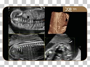 Ultrasonography Esaote Medical Equipment Technology Magnetic Resonance Imaging PNG