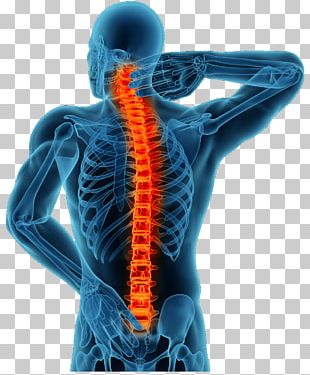 Neck Pain Back Pain Shoulder Pain Spinal Disc Herniation PNG, Clipart ...