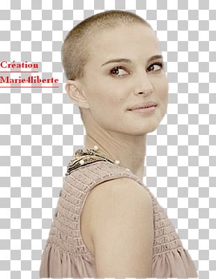 Beauty Hairstyle Hair Loss Aesthetics PNG