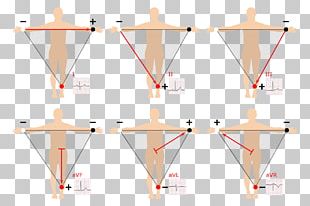 Vectorcardiography PNG Images, Vectorcardiography Clipart Free Download